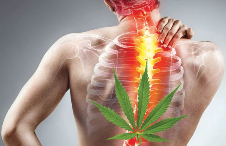 natural pain relief, cannabis for pain, chronic pain relief